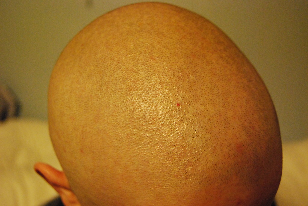 Close-up of the top of a freshly shaved bald head showing fine stubble regrowth between shaves
